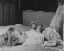 St. John's Hospital, Child in Traction Going Through Long Recuperation.
