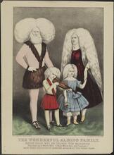 The Wonderful Albino Family.
